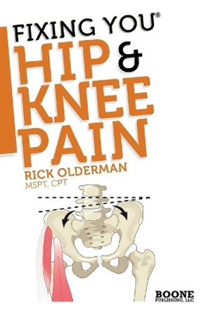 Fixing You: Hip & Knee Pain: Self-treatment for Hip Pain, Bursitis, Anterior Knee Pain, Hamstring Strains and Other Diagnoses by Rick Olderman 9780982193723