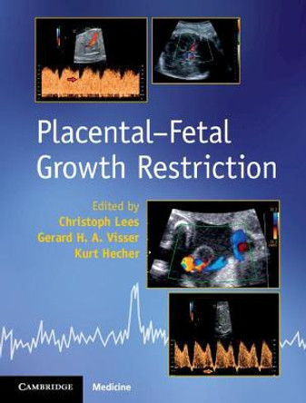 Placental-Fetal Growth Restriction by Christoph Lees