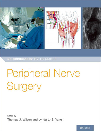 Peripheral Nerve Surgery by Dr Thomas Wilson 9780190617127