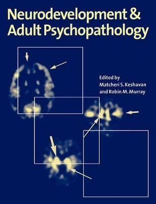 Neurodevelopment and Adult Psychopathology by Matcheri S. Keshavan 9780521485654
