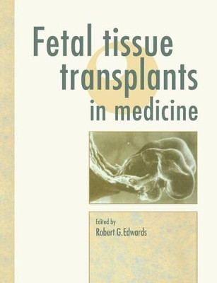 Fetal Tissue Transplants in Medicine by Robert G. Edwards 9780521116923