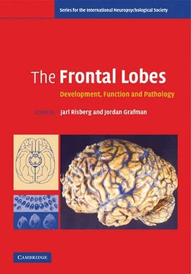 The Frontal Lobes: Development, Function and Pathology by Jarl Risberg 9780521672252