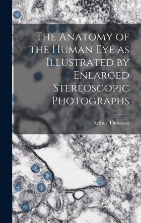 The Anatomy of the Human eye as Illustrated by Enlarged Stereoscopic Photographs by Arthur Thomson 9781018611860