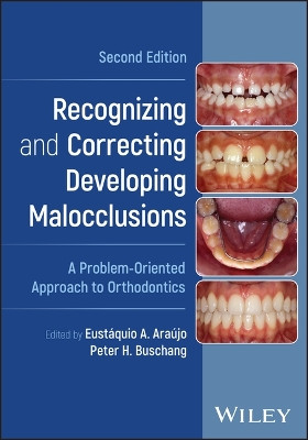 Recognizing and Correcting Developing Malocclusions: A Problem-Oriented Approach to Orthodontics Eustáquio A. Araújo 9781119912545