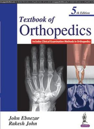 Textbook of Orthopedics by John Ebnezar