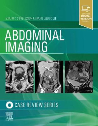 Abdominal Imaging: Case Review Series by Manjiri Dighe