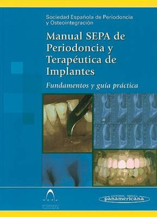 Manual Sepa de Periodoncia y Terapeutica de Implantes. Fundamentos y Guia Practica by Espanola De Periodoncia y Osteointegracio Sociedad