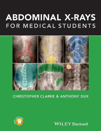 Abdominal X-rays for Medical Students by Christopher Clarke