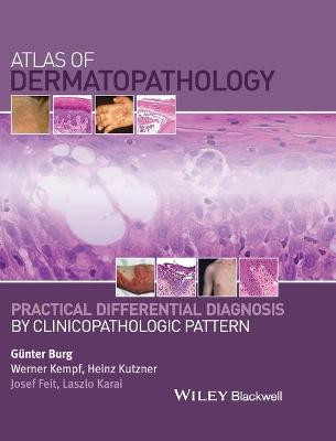 Atlas of Dermatopathology: Practical Differential Diagnosis by Clinicopathologic Pattern Gunter Burg (Department of Dermatology, University Hospital Zurich, Zurich, Switzerland) 9781118658314