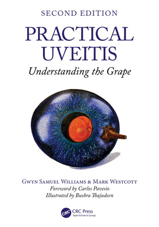 Practical Uveitis: Understanding the Grape Gwyn Samuel Williams 9781032757230