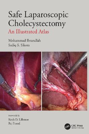 Safe Laparoscopic Cholecystectomy: An Illustrated Atlas by Mohammad Ibrarullah