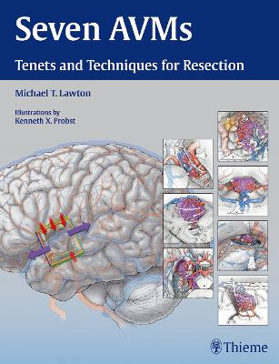 Seven AVMs: Tenets and Techniques for Resection by Michael T. Lawton