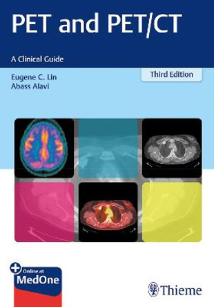 PET and PET/CT: A Clinical Guide by Eugene C. Lin