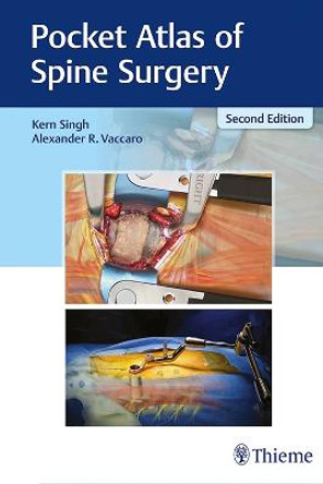 Pocket Atlas of Spine Surgery by Kern Singh