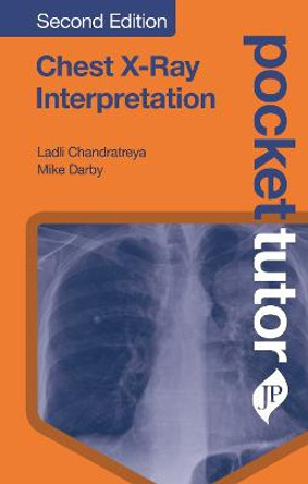 Pocket Tutor Chest X-Ray Interpretation by Ladli Chandratreya