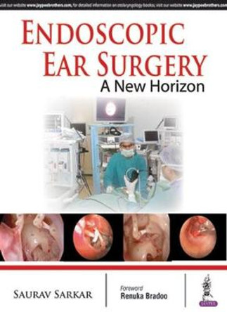 Endoscopic Ear Surgery: A New Horizon by Saurav Sarkar