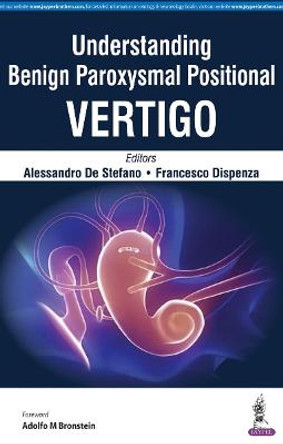 Understanding Benign Paroxysmal Positional Vertigo by Alessandro de Stefano