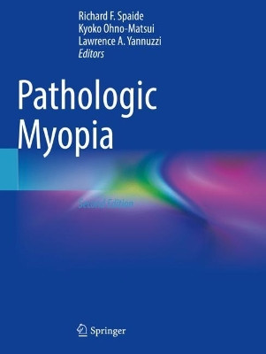 Pathologic Myopia by Richard F. Spaide 9783030743369