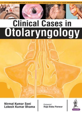 Clinical Cases in Otolaryngology by Nirmal Kumar Soni 9789385891618