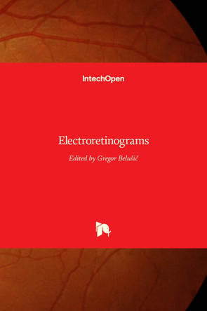 Electroretinograms by Gregor Belusic 9789533073835