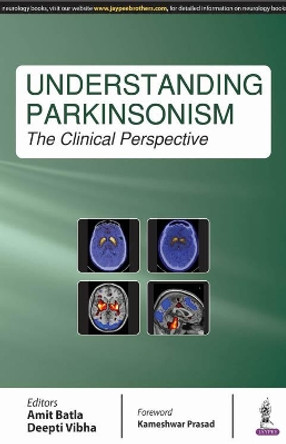 Understanding Parkinsonism: The Clinical Perspective by Deepti Vibha 9789386322333