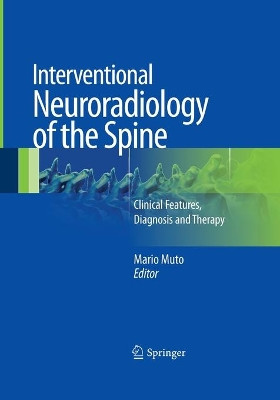 Interventional Neuroradiology of the Spine: Clinical Features, Diagnosis and Therapy by Mario Muto 9788847039308