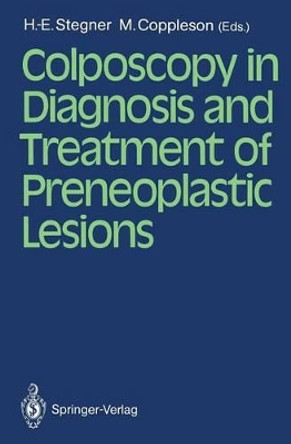 Colposcopy in Diagnosis and Treatment of Preneoplastic Lesions by Hans-Egon Stegner 9783540179474