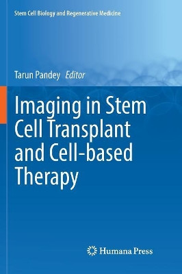 Imaging in Stem Cell Transplant and Cell-based Therapy by Tarun Pandey 9783319847528