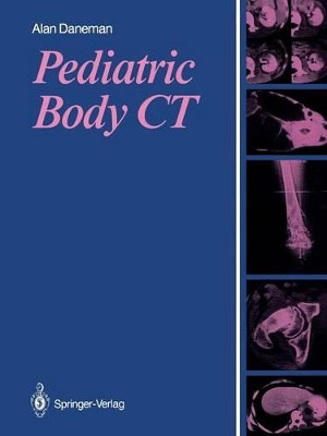 Pediatric Body CT by Alan Daneman 9781447131397