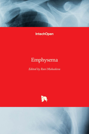 Emphysema by Ravi Mahadeva 9789535104339