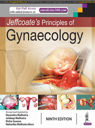 Jeffcoate's Principles of Gynaecology by Narendra Malhotra 9789352704774