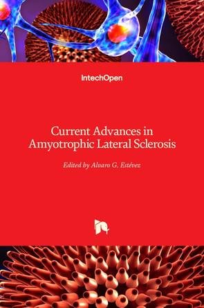 Current Advances in Amyotrophic Lateral Sclerosis by Alvaro Estévez 9789535111955