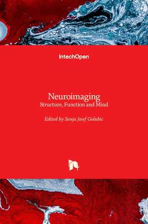 Neuroimaging: Structure, Function and Mind by Sanja Josef Golubic 9781789858051