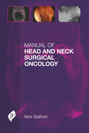 Manual of Head and Neck Surgical Oncology by Nick Stafford 9781907816697