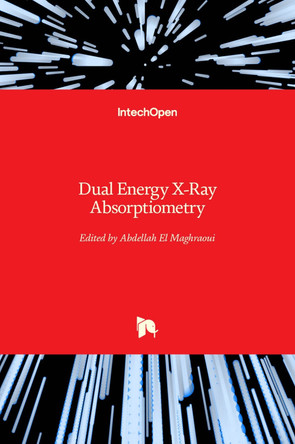 Dual Energy X-Ray Absorptiometry by Abdellah El Maghraoui 9789533078779