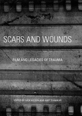 Scars and Wounds: Film and Legacies of Trauma by Nick Hodgin 9783319822440