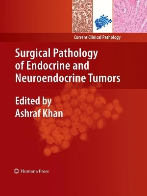 Surgical Pathology of Endocrine and Neuroendocrine Tumors by Ashraf Khan 9781493961153