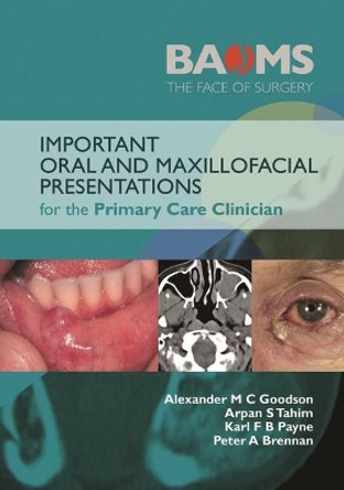 Important Oral and Maxillofacial Presentations for the Primary Care Clinician by Alexander M. C. Goodson 9781909818934