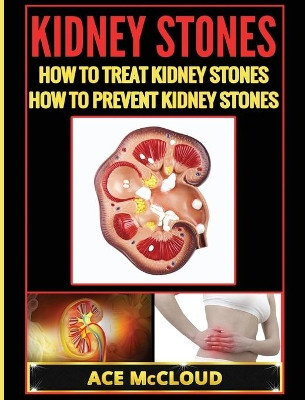 Kidney Stones: How To Treat Kidney Stones: How To Prevent Kidney Stones by Ace McCloud 9781640482968