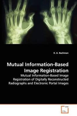 Mutual Information-Based Image Registration by K A Bachman 9783836484831