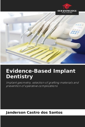 Evidence-Based Implant Dentistry by Janderson Castro Dos Santos 9786208280956