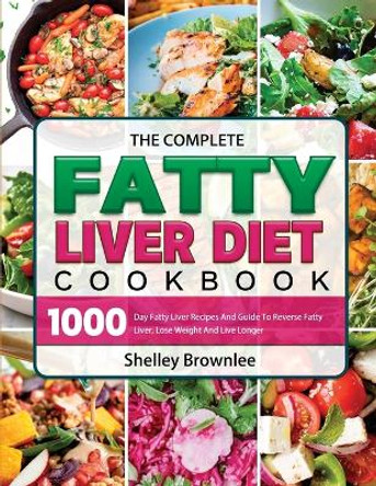 The Complete Fatty Liver Diet Cookbook: 1000 Day Fatty Liver Recipes And Guide To Reverse Fatty Liver, Lose Weight And Live Longer by Shelley Brownlee 9781803208657