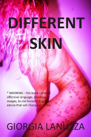 Different Skin by Giorgia Lanuzza 9781915229748