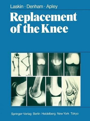 Replacement of the Knee by R. S. Laskin 9781447113553