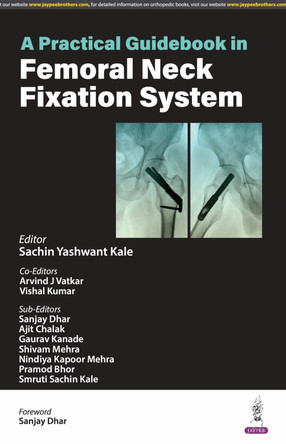 A Practical Guidebook in Femoral Neck Fixation System by Sachin Yashwant Kale 9789356965959