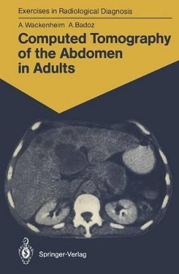 Computed Tomography of the Abdomen in Adults: 85 Radiological Exercises for Students and Practitioners by Auguste Wackenheim 9783540165408