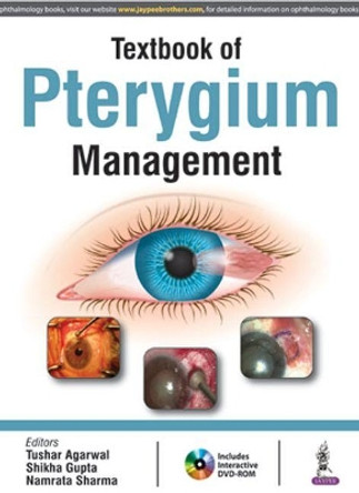 Textbook of Pterygium Management by Tushar Agarwal 9789386261540