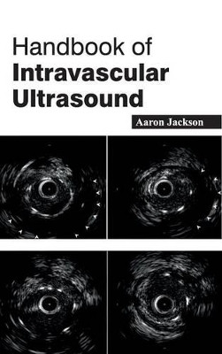 Handbook of Intravascular Ultrasound by Aaron Jackson 9781632422088
