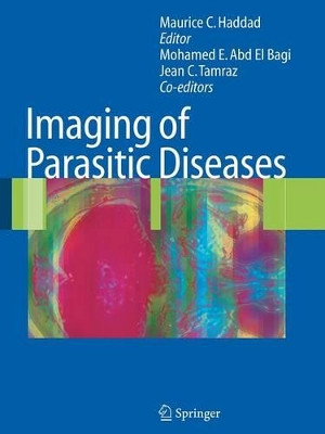 Imaging of Parasitic Diseases by Mohamed E. Abd El Bagi 9783642080456