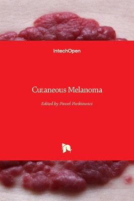 Cutaneous Melanoma by Paweł Pietkiewicz 9781789841398